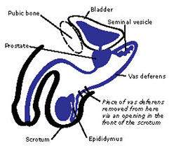 Anatomy of a vasectomy
